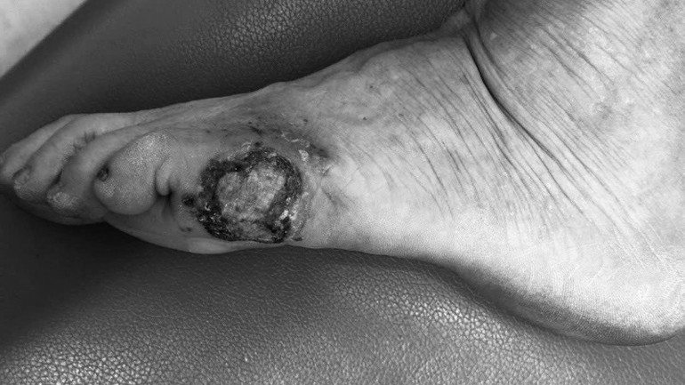 Hình ảnh tổn thương của bệnh nhân.