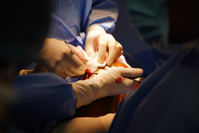 Ca phẫu thuật diễn ra thành công.