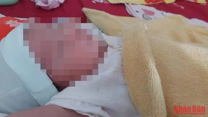 Em bé chào đời khỏe mạnh không mang virus dù mẹ nhiễm HIV. Em bé chào đời khỏe mạnh không mang virus dù mẹ nhiễm HIV.