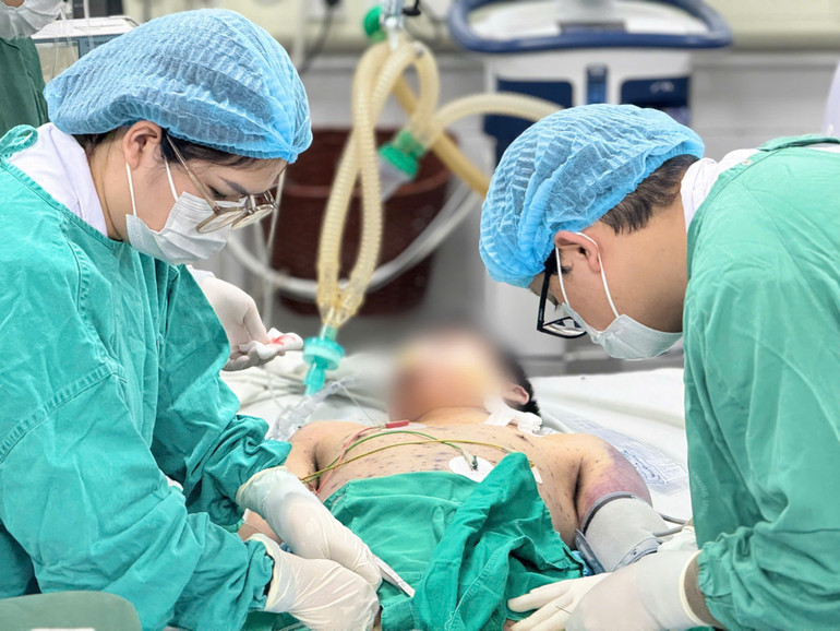 Dù được điều trị tích cực, tình trạng sốc vẫn tiến triển nặng, bác sĩ phải dùng phối hợp hai loại thuốc vận mạch liều cao và đặt ECMO để hỗ trợ tuần hoàn.