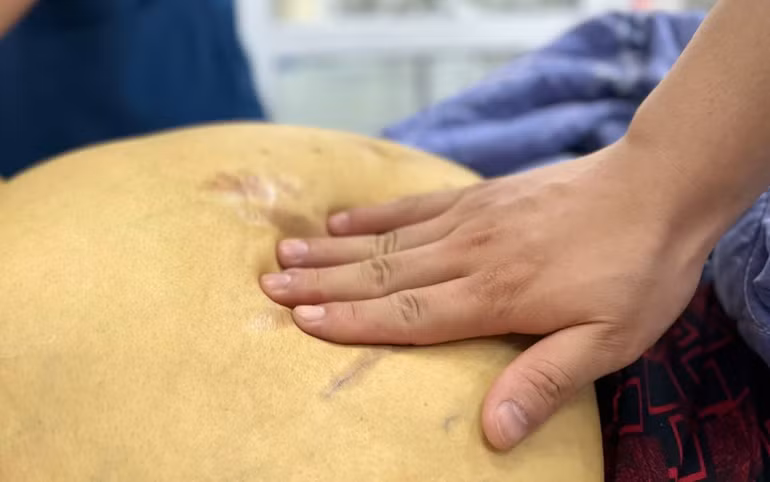 Bệnh nhân có da và mắt vàng sẫm, phù toàn thân.