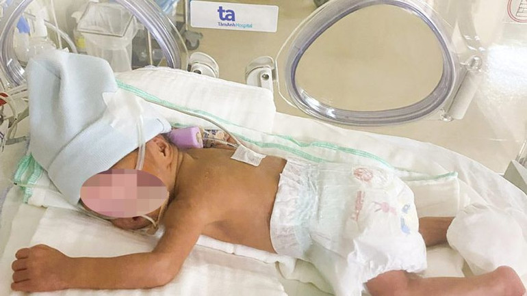 Trẻ chào đời nặng 1,1kg, được chăm sóc đặc biệt tại Trung tâm Sơ sinh.