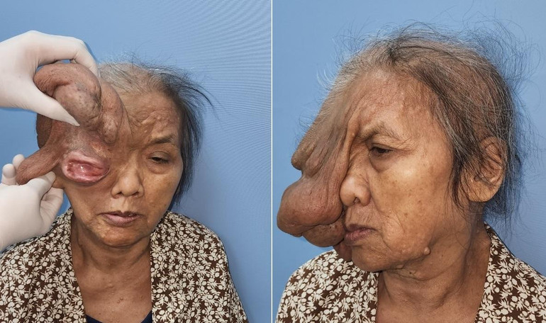 Hình ảnh bệnh nhân trước phẫu thuật. Hình ảnh bệnh nhân trước phẫu thuật.