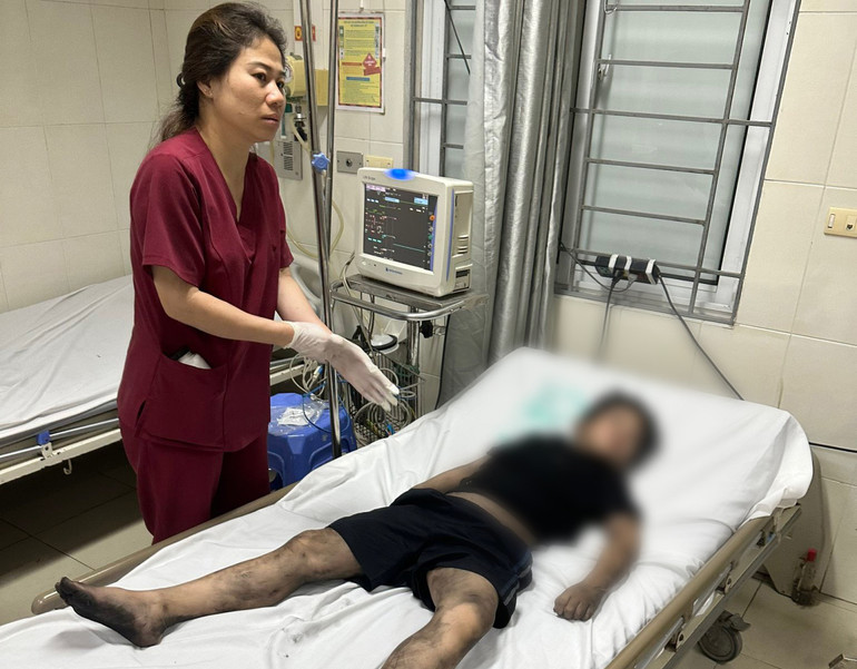 Nạn nhân trong vụ cháy tại quận Đống Đa được điều trị.
