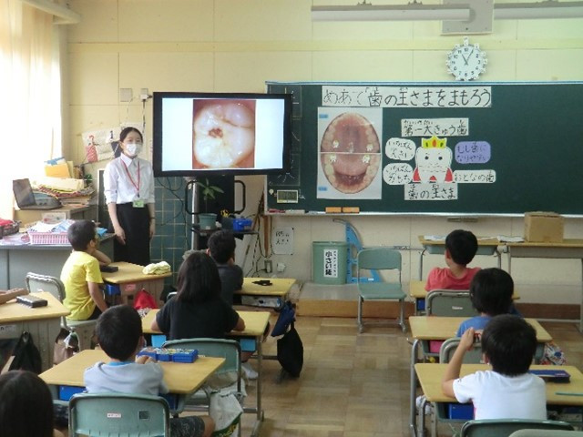 Tại Nhật Bản, Yogo Teachers - Giáo viên y tế học đường được công nhận như một giáo viên chuyên môn. 