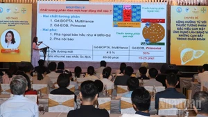 Hội thảo mang đến nhiều kiến thức mới, cập nhật các tiến bộ y học trong chẩn đoán hình ảnh và điều trị bệnh lý gan mật. (Ảnh: ANH ĐÀO)