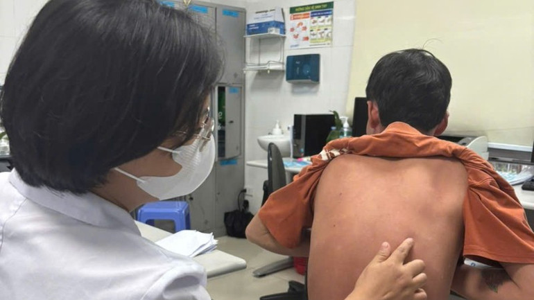 Thạc sĩ, bác sĩ Nguyễn Thị Mai Hương - Khoa Điều trị nội trú ban ngày, Bệnh viện Da liễu Trung ương khám cho bệnh nhân. df6c7941-2a68-417b-9f00-f3396db9d-5962.jpg