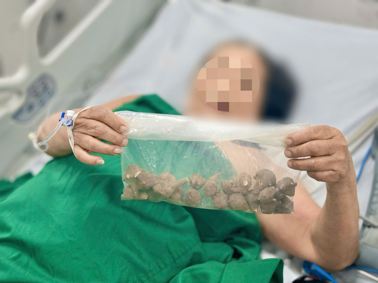 Hình ảnh củ ấu tầu mà bệnh nhân mua qua mạng. z7166546717511-5ce481494c890f50db1bf8cf44f4331c.jpg