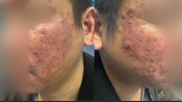 Tổn thương viêm da của bệnh nhân. 514253366-3120940954722904-5830851686432653602-n-2237.jpg