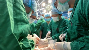 Các thầy thuốc thực hiện ca ghép phổi cuối năm. 