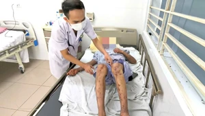 Bệnh nhân rơi vào tình trạng mù tạm thời. 