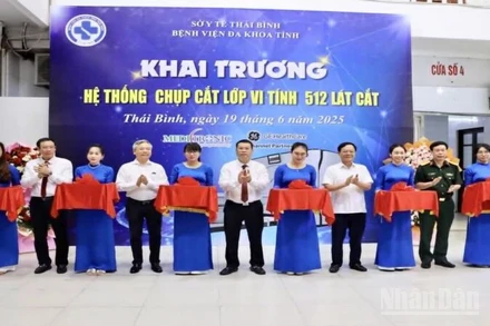 Các đại biểu thực hiện nghi thức cắt băng khai trương hệ thống chụp cắt lớp vi tính 512 lát cắt.