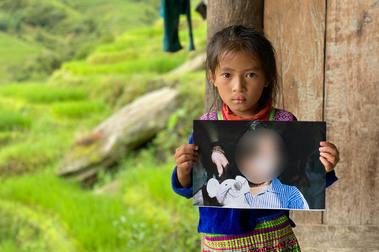 Cừ Thị Sớ đã có đôi môi đẹp và dần lành lặn sau hành trình 3 năm điều trị và phẫu thuật.