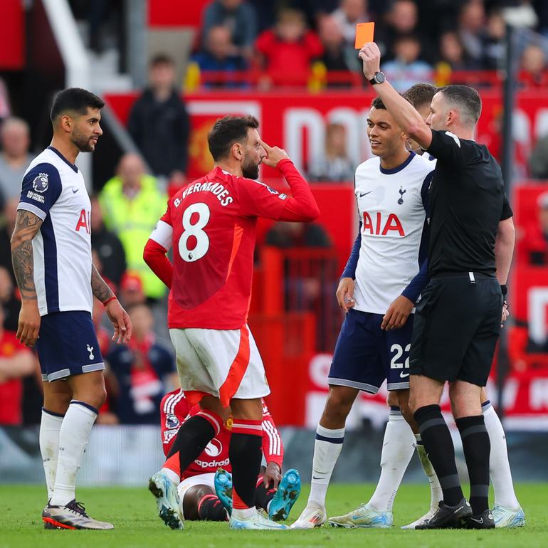 Bruno nhận thẻ đỏ ngớ ngẩn trong trận thua 0-3 trước Spurs. (Ảnh: TheSun)