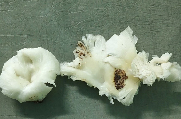 Loại nấm rừng gây ngộ độc 3 người dân xã Ga Ry