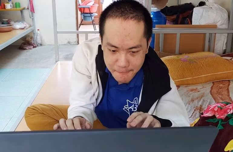 Dù mang trong mình căn bệnh bẩm sinh khó chữa, nhưng khuôn mặt của sinh viên Nguyễn Văn Thắm luôn toát lên nghị lực vượt khó trong học tập.