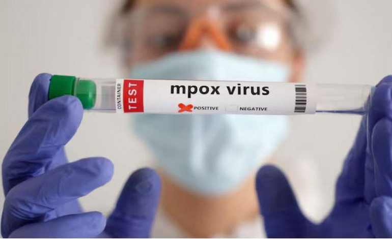 Nhiều nước ở châu Phi cũng không có đủ trang thiết bị cần thiết để theo dõi và giám sát dịch bệnh. (Nguồn: Reuters)