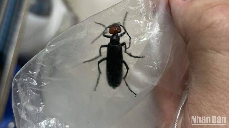 Sâu Ban Miêu, loại côn trùng bệnh nhân đã ăn khi nhập viện. Sâu Ban Miêu, loại côn trùng bệnh nhân đã ăn khi nhập viện.