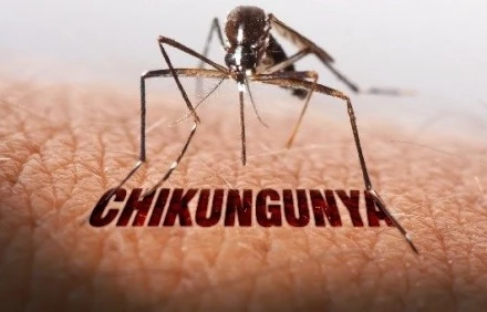 Singapore: Cảnh báo nguy cơ lây truyền virus chikungunya
