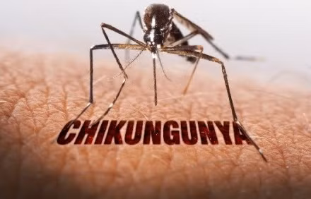 Singapore: Cảnh báo nguy cơ lây truyền virus chikungunya