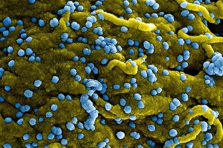 WHO: Ethiopia tuyên bố khống chế được đợt bùng phát virus Marburg