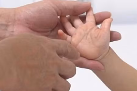 Bệnh nhi mắc tay chân miệng điều trị tại Bệnh viện Nhi Trung ương. (Ảnh: BVCC)