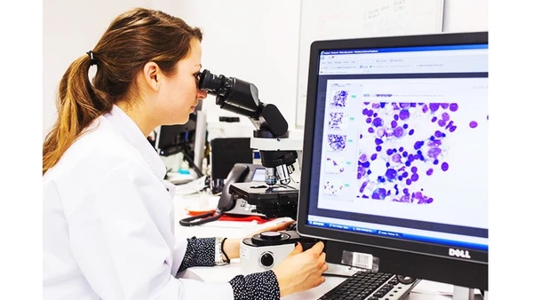 Nghiên cứu điều trị bệnh bạch cầu lymphocytic mãn tính. Ảnh: ALARMY