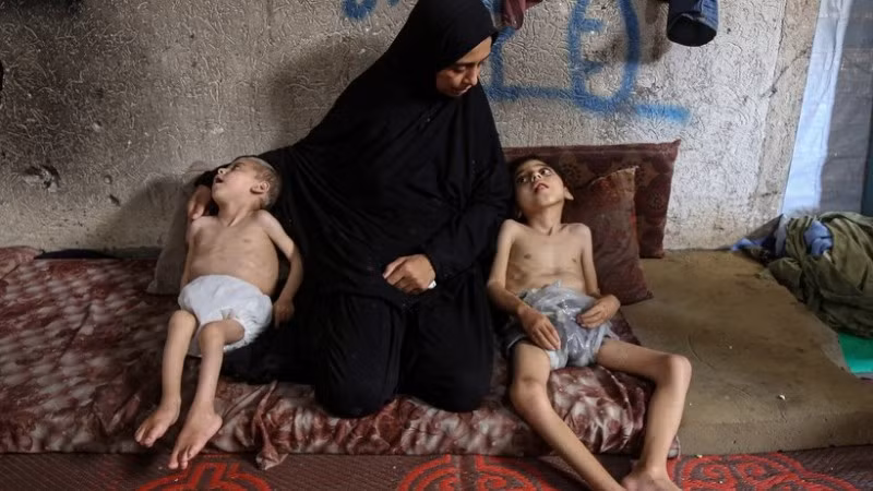 Trẻ em bị suy dinh dưỡng tại Dải Gaza. (Ảnh: THX/TTXVN)