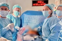 Ê-kíp bác sĩ thực hiện ca can thiệp tim bào thai lần thứ 13.