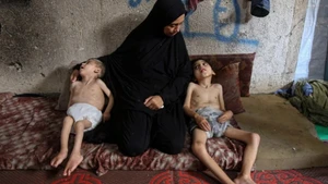 Trẻ em bị suy dinh dưỡng tại Dải Gaza. (Ảnh: THX/TTXVN)