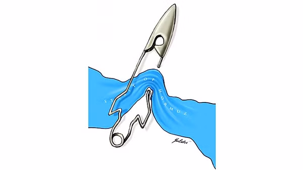 Biếm họa: MUZAFFAR YULCHIBOEV