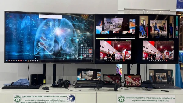 Phần mềm ứng dụng AI trong chẩn đoán ung thư phổi được trưng bày và giới thiệu tại triển lãm 80 năm hành trình Độc lập-Tự do-Hạnh phúc.