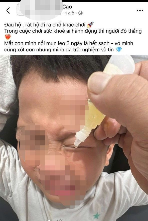 Một số người tin rằng nhỏ chanh vào mắt có thể trị lẹo. (Ảnh chụp màn hình) Một số người tin rằng nhỏ chanh vào mắt có thể trị lẹo. (Ảnh chụp màn hình)