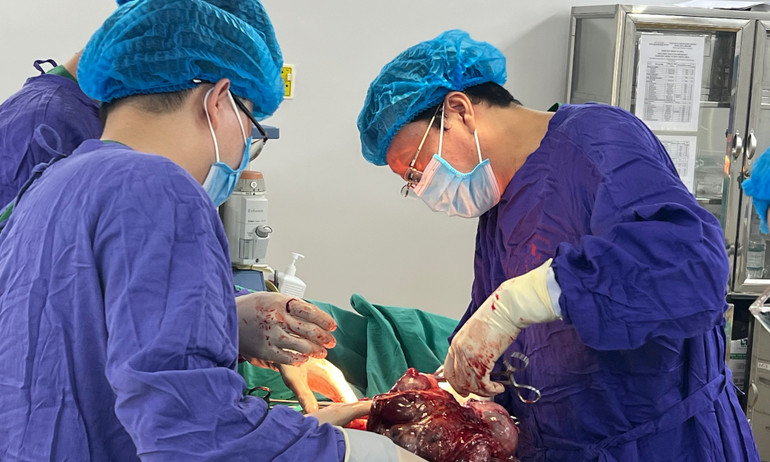Khối u nặng hơn 7kg được lấy ra khỏi ổ bụng người bệnh.