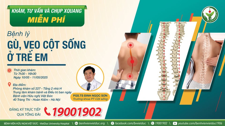 Thông tin khám và tư vấn miễn phí cho trẻ em mắc gù vẹo cột sống ở Bệnh viện Hữu Nghị Việt Đức.
