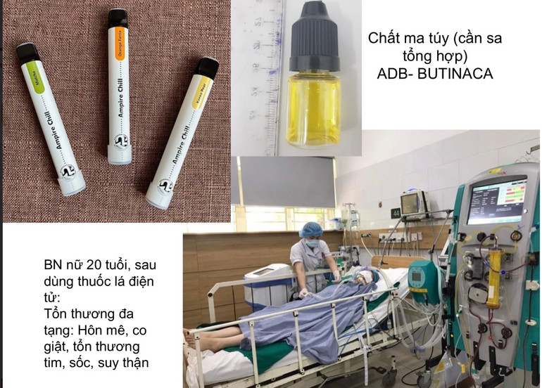 Một bệnh nhân cấp cứu tại Trung tâm chống độc sau khi dùng thuốc lá điện tử có chất ma túy. Một bệnh nhân cấp cứu tại Trung tâm chống độc sau khi dùng thuốc lá điện tử có chất ma túy.