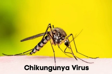 [Video] Nga ghi nhận ca sốt chikungunya nhập cảnh đầu tiên năm 2025