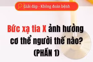 [Video] Bức xạ tia X ảnh hưởng cơ thể người thế nào - Phần 1