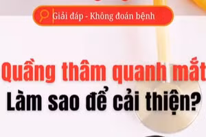 [Video] Làm sao để cải thiện quầng thâm quanh mắt?