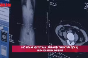 [Video] Bảo hiểm xã hội Việt Nam làm rõ việc thanh toán dịch vụ chẩn đoán hình ảnh BHYT