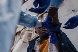 Một bệnh nhân mắc bệnh đậu mùa khỉ đang được điều trị tại một bệnh viện ở ngoại ô Goma, tỉnh Bắc Kivu, miền đông CHDC Congo. Ảnh: THX