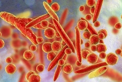 WHO bác thông tin về virus lạ gây triệu chứng ho ra máu ở Nga