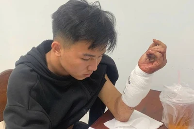 Nghi phạm Đặng Minh Hiền đang bị cơ quan Công an tạm giữ để điều tra hành vi giết người. (Ảnh: HOÀNG TRUNG)