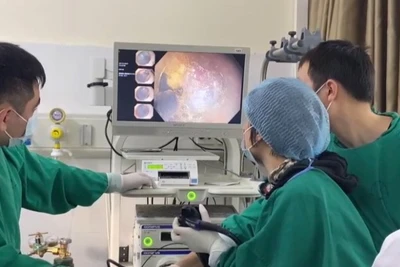 Các bác sĩ Bệnh viện 19-8 nội soi cắt tách dưới niêm mạc điều trị ung thư dạ dày sớm cho bệnh nhân. (Ảnh: cand.com.vn)