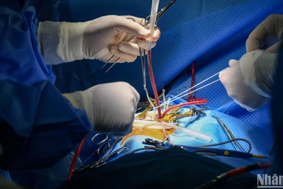 700 ca phẫu thuật tim ít xâm lấn và hành trình làm chủ kỹ thuật mới của các bác sĩ tim nhi