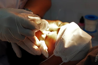 Điểm "khác lạ" của bệnh đau mắt đỏ mùa dịch năm 2023