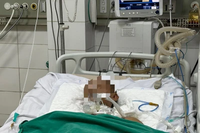 Người bệnh mắc uốn ván nguy kịch.