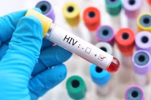 Sửa quy định về cấp giấy chứng nhận bị phơi nhiễm với HIV, bị nhiễm HIV do tai nạn rủi ro nghề nghiệp. (Ảnh minh họa)