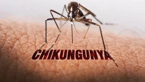 Singapore: Cảnh báo nguy cơ lây truyền virus chikungunya