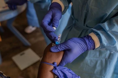 Một người mắc bệnh đậu mùa khỉ được điều trị tại bệnh viện ở ngoại ô thành phố Goma, tỉnh Bắc Kivu, miền đông Cộng hòa Dân chủ Congo (DRC), ngày 19/8/2024. (Ảnh: Tân Hoa xã)